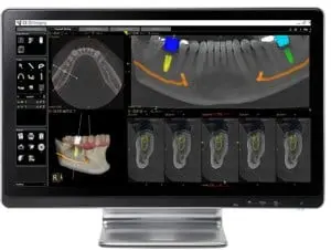Third Coast OMS Computerized Planning
